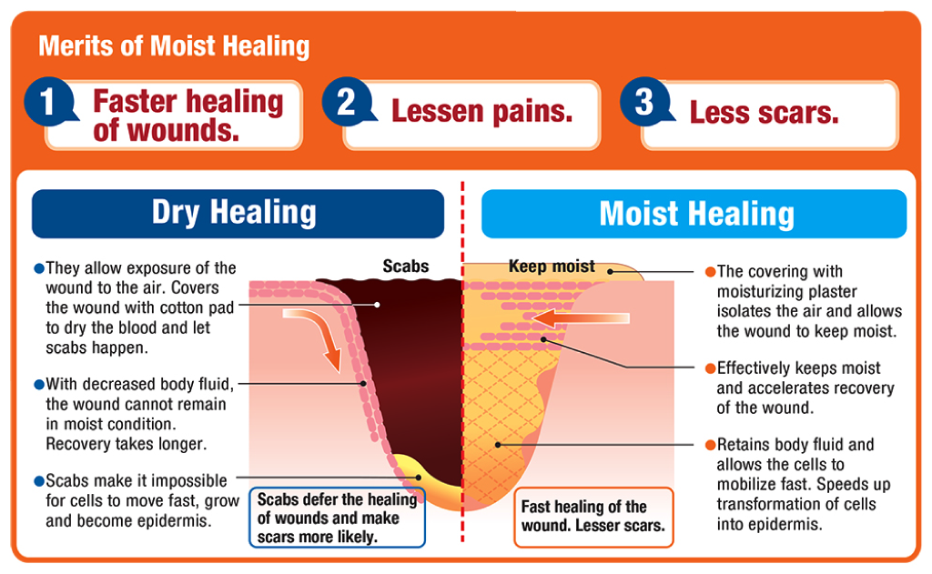 20241011_Hydrocolloid Dressings for Moisture Retention in Dry Wounds