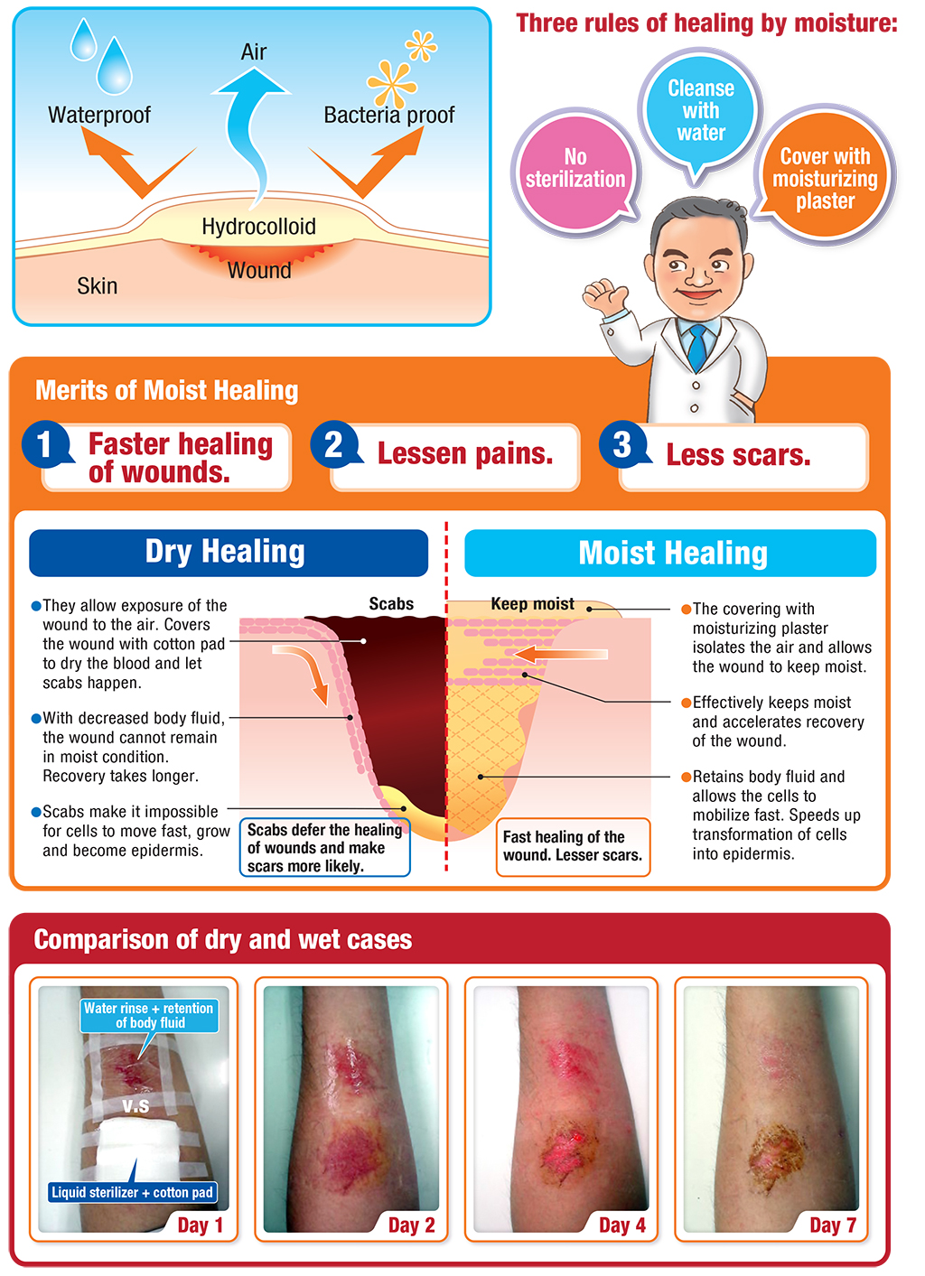 TRIDA IGIBAN Hydrocolloid Dressings vs Traditional Dressings A Revolutionary Comparison (EN)