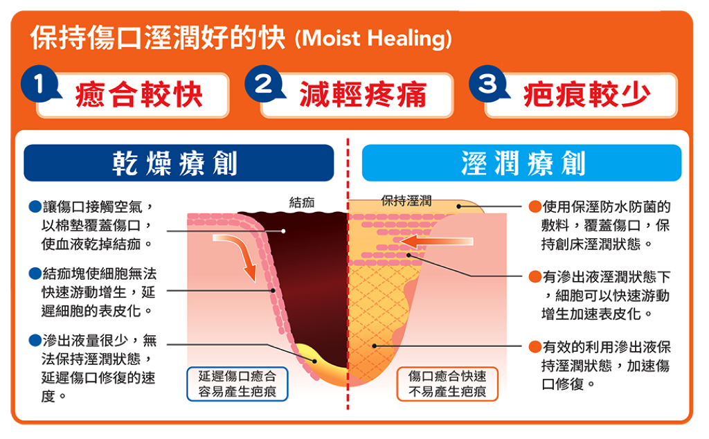 20241011_Hydrocolloid Dressings for Moisture Retention in Dry Wounds_TW