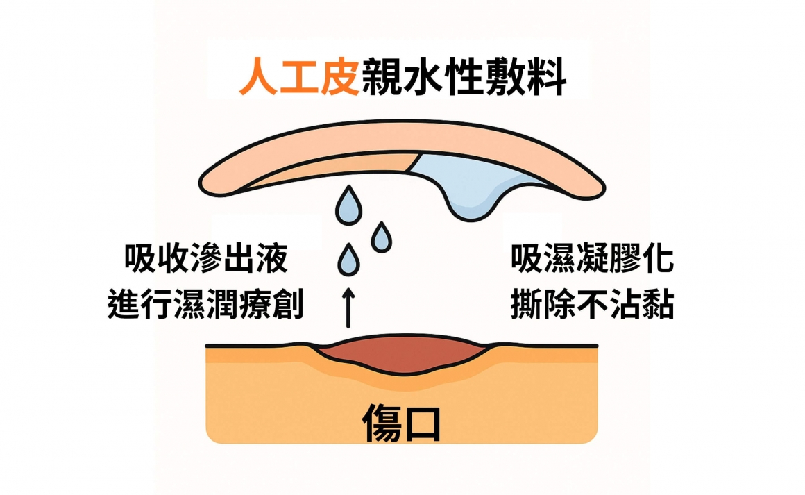 what is Hydrocolloid dressing how to use 02 (1) what is Hydrocolloid dressing how to use 02 (1)